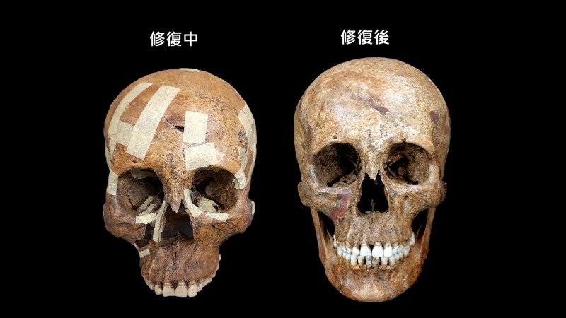 M6顱骨修復中（左）與用蠟填補完畢（右）