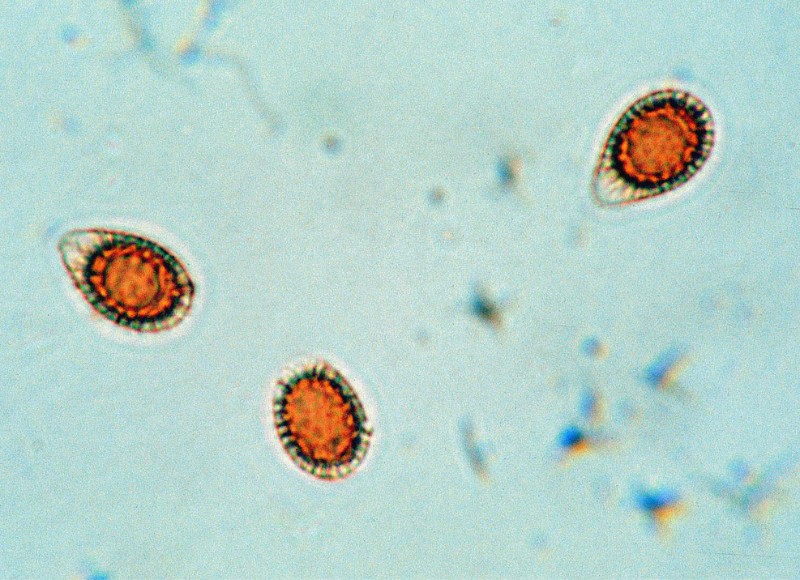 顯微鏡觀察的靈芝擔孢子