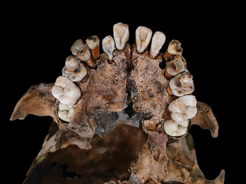 M38（7-9歲）上頜的箕形門齒。(圖/陳志誠)