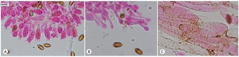 微觀照：苔蘚盔孢傘的擔子（A）、孢子與緣囊狀體（B）及菌蓋表皮菌絲（C）