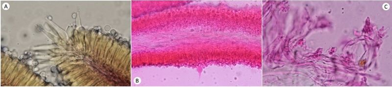 微觀照：紅紫柄小菇經Melzer's染劑染色後的菌褶切面與孢子（A）、菌褶側面之囊狀體（B）與菌傘表皮分枝狀菌絲（C）