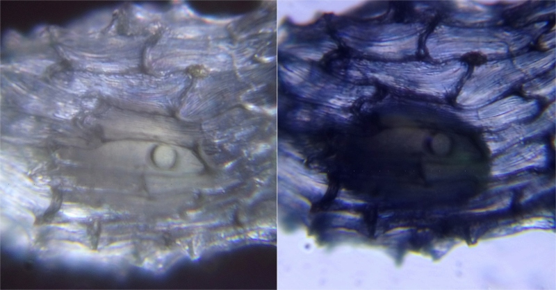 風蘭種子內的胚，左:斜射光的暗視野效果，右:直射穿透光。